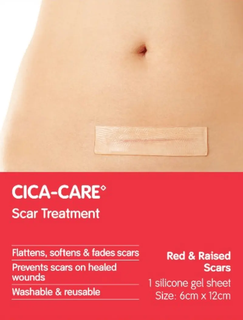 Cica-Care Silicone Scar Sheet – Clinically Proven For Cesarean & Surgical Scar Management 1